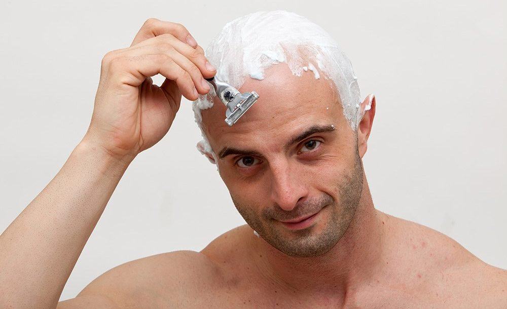 Should I Shave my Head Bald? The Dappered Guide to Losing your Hair.